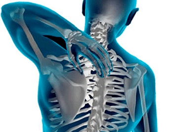 Manifestations of osteochondrosis of the spine of the chest